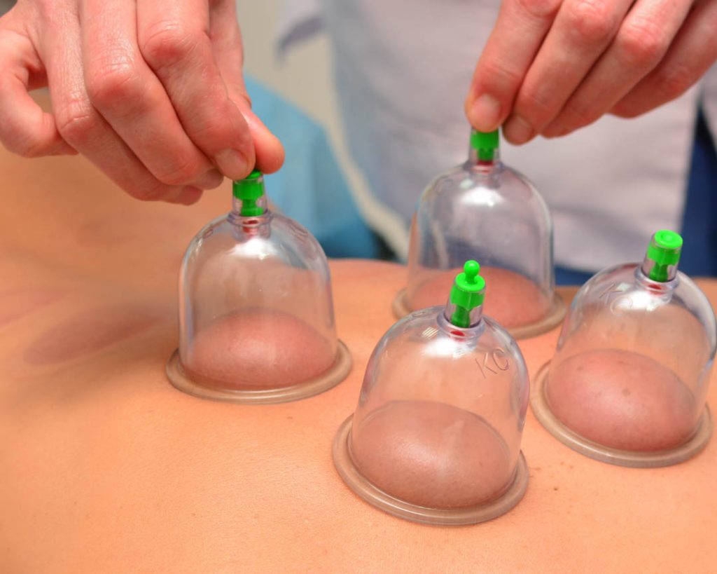 hijama center in dubai منصة مطبخك